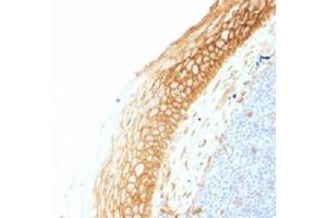 Immunohistochemistry (IHC) image for anti-Catenin, beta (CATNB) antibody (ABIN4949465)