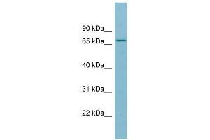 WB Suggested Anti-SLC27A5 Antibody Titration:  0.