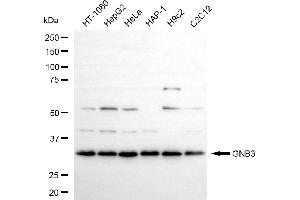 Western blotting analysis using GNB3 antibody (ABIN7798820).