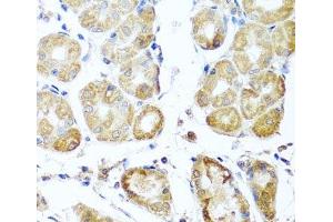 Immunohistochemistry of paraffin-embedded Human stomach using PER1 Polyclonal Antibody at dilution of 1:100 (40x lens). (PER1 Antikörper)