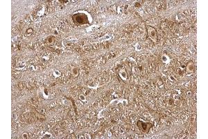 Immunohistochemistry (IHC) image for anti-Valosin Containing Protein (VCP) (N-Term) antibody (ABIN2856882)