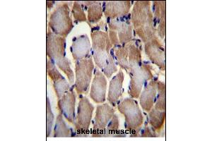 SEPN1 Antibody (C-term) (ABIN656385 and ABIN2845680) immunohistochemistry analysis in formalin fixed and paraffin embedded human skeletal muscle followed by peroxidase conjugation of the secondary antibody and DAB staining. (SEPN1 Antikörper  (C-Term))
