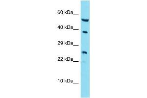 Host: Rabbit Target Name: RAB42 Sample Type: A549 Whole Cell lysates Antibody Dilution: 1. (RAB42 Antikörper  (C-Term))