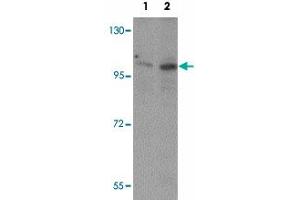 Western blot analysis of ZMIZ2 in A-20 cell lysate with ZMIZ2 polyclonal antibody  at (1) 0.