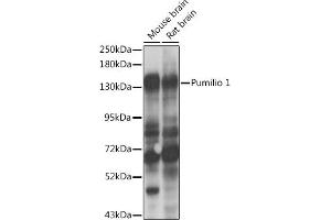 Western blot analysis of extracts of various cell lines, using Pumilio 1 antibody  at 1:1000 dilution. (PUM1 Antikörper  (AA 1-280))