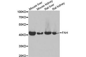 Western blot analysis of extracts of various cell lines, using FAH antibody.