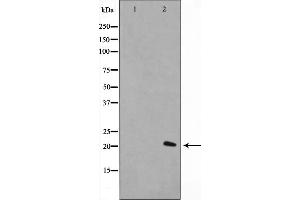 Western blot analysis on A549 cell lysate using Histone H1. (Histone H1 Antikörper  (Internal Region))