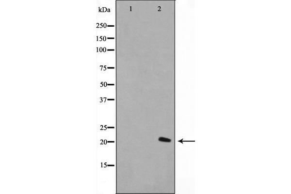 Histone H1 anticorps  (Internal Region)