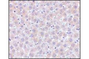 Immunohistochemistry of sRANK-L in human liver tissue with this product at 5 μg/ml. (RANKL Antikörper  (Center))