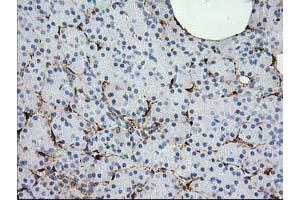 Image no. 1 for anti-Alcohol Dehydrogenase 1B (Class I), beta Polypeptide (ADH1B) antibody (ABIN1496479) (ADH1B Antikörper)