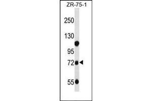 Western blot analysis of Beta-glucuronidase Antibody (C-term) in ZR-75-1 cell line lysates (35ug/lane). (Glucuronidase beta Antikörper  (C-Term))