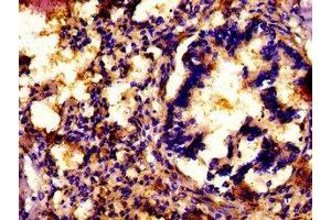 IHC image of ABIN7154307 diluted at 1: 500 and staining in paraffin-embedded human lung tissue performed on a Leica BondTM system. (ATP7A Antikörper  (AA 257-488))
