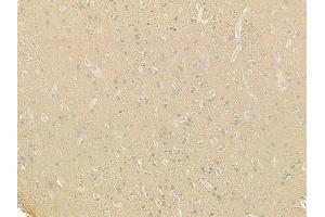 ABIN6257616 and ABIN6275245 at 1/100 staining human glioblastoma by IHC-P. (MRPL49 Antikörper  (Internal Region))