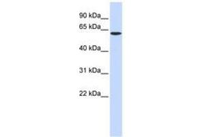 Image no. 1 for anti-serine Palmitoyltransferase, Long Chain Base Subunit 1 (SPTLC1) (AA 216-265) antibody (ABIN6740984) (SPTLC1 Antikörper  (AA 216-265))