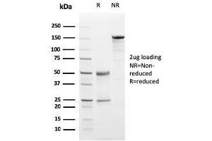 SDS-PAGE Analysis Purified Progesterone Receptor Mouse Monoclonal Antibody (PGR/2694). (Progesterone Receptor Antikörper  (AA 483-571))