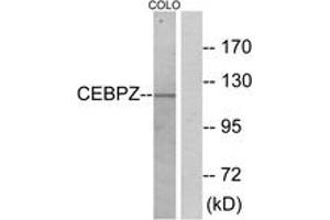 Western blot analysis of extracts from COLO cells, using CEBPZ Antibody.