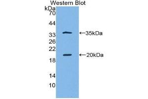 Western Blotting (WB) image for anti-serine Peptidase Inhibitor, Kazal Type 5 (SPINK5) (AA 699-976) antibody (ABIN1860613) (SPINK5 Antikörper  (AA 699-976))