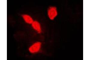 Immunofluorescent analysis of hnRNP A1 staining in K562 cells. (HNRNPA1 Antikörper  (Center))