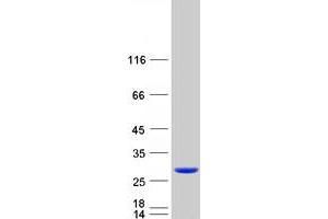 Western Blotting (WB) image for Myosin, Light Chain 6B, Alkali, Smooth Muscle and Non-Muscle (MYL6B) protein (Myc-DYKDDDDK Tag) (ABIN2726674)