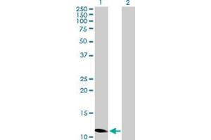 Western Blot analysis of ZNF695 expression in transfected 293T cell line by ZNF695 MaxPab polyclonal antibody. (ZNF695 Antikörper  (AA 1-133))