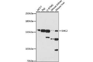 Western blot analysis of extracts of various cells, using SMC2 antibody (ABIN7270615) at 1:1000 dilution. (SMC2 Antikörper  (AA 700-900))