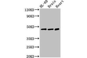 Western Blot Positive WB detected in: HL60 whole cell lysate, Mouse brain tissue, Rat heart tissue All lanes: CHST1 antibody at 3 μg/mL Secondary Goat polyclonal to rabbit IgG at 1/50000 dilution Predicted band size: 47 kDa Observed band size: 47 kDa (CHST1 Antikörper  (AA 305-397))