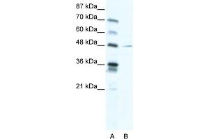 WB Suggested Anti-NFIC Antibody Titration:  2. (NFIC Antikörper  (C-Term))
