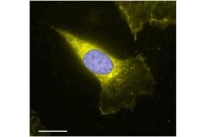 Expression of TRPC4 in human  cells.