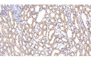 Immunohistochemistry (IHC) image for anti-Secreted Frizzled-Related Protein 1 (SFRP1) (AA 8-153) antibody (ABIN7436171)