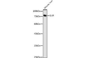 Western blot analysis of extracts of Mouse liver, using IL6R antibody (ABIN3015521, ABIN3015522, ABIN3015523, ABIN1680455 and ABIN6218635) at 1:1000 dilution. (IL-6 Receptor Antikörper  (AA 20-320))