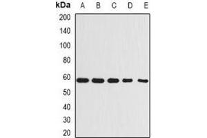 Western blot analysis of Beclin-1 expression in A431 (A), MCF7 (B), Raji (C), mouse kidney (D), rat brain (E) whole cell lysates. (Beclin 1 Antikörper)
