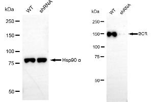 Western blotting analysis using BCR antibody (ABIN7797789). (Rekombinanter BCR Antikörper)