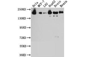 Western Blot Positive WB detected in: Hela whole cell lysate, MCF-7 whole cell lysate, L02 whole cell lysate, HepG2 whole cell lysate, Mouse Brain whole cell lysate, Rat Brain whole cell lysate All lanes: ROCK2 antibody at 1:1000 Secondary Goat polyclonal to rabbit IgG at 1/50000 dilution Predicted band size: 161 kDa Observed band size: 161 kDa (Rekombinanter ROCK2 Antikörper)