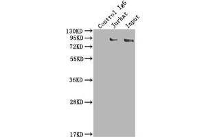 Immunoprecipitating SUZ12 in K562 whole cell lysate Lane 1: Rabbit control IgG instead of ABIN7127832 in K562 whole cell lysate. (Rekombinanter SUZ12 Antikörper)
