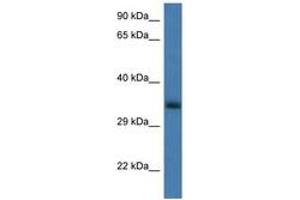 Image no. 1 for anti-Glucosamine-6-Phosphate Deaminase 1 (GNPDA1) (AA 50-99) antibody (ABIN6747378) (GNPDA1 Antikörper  (AA 50-99))