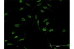 Immunofluorescence (IF) image for anti-Xeroderma Pigmentosum, Complementation Group A (XPA) (AA 1-273) antibody (ABIN948624)