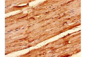 Immunohistochemistry (IHC) image for anti-Solute Carrier Family 2 (Facilitated Glucose Transporter), Member 4 (SLC2A4) (AA 223-287) antibody (ABIN7170123)