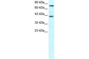 Western Blotting (WB) image for anti-Zinc Finger Protein 652 (ZNF652) antibody (ABIN2460271) (ZNF652 Antikörper)