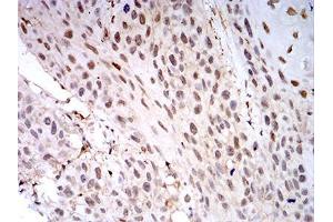 Immunohistochemistry (IHC) image for anti-Lectin, Galactoside-Binding, Soluble, 1 (LGALS1) (AA 1-135) antibody (ABIN5542520)