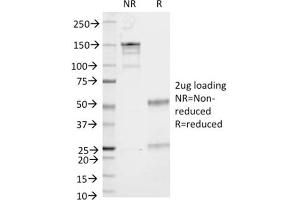 SDS-PAGE Analysis Purified CD86 Mouse Monoclonal Antibody (C86/1146).