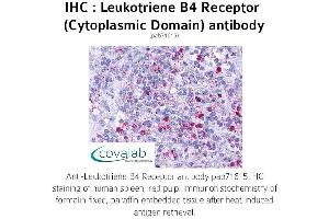 Image no. 1 for anti-Leukotriene B4 Receptor (LTB4R) (3rd Cytoplasmic Domain) antibody (ABIN1736422) (Leukotriene B4 Receptor/BLT Antikörper  (3rd Cytoplasmic Domain))