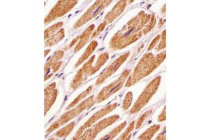 (ABIN391039 and ABIN2841206) staining PDK4 in human heart tissue sections by Immunohistochemistry (IHC-P - paraformaldehyde-fixed, paraffin-embedded sections). (PDK4 Antikörper  (C-Term))
