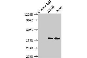 Immunoprecipitating ARG2 in HEK293 whole cell lysate Lane 1: Rabbit control IgG (1 μg) instead of ABIN7144586 in HEK293 whole cell lysate. (ARG2 Antikörper  (AA 1-354))