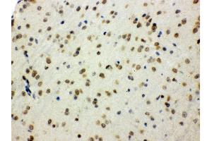 Anti- SHC1 Picoband antibody, IHC(P) IHC(P): Mouse Brain Tissue (SHC1 Antikörper  (C-Term))