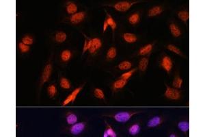 Immunofluorescence analysis of U2OS cells using OTUB1 Polyclonal Antibody at dilution of 1:100. (OTUB1 Antikörper)