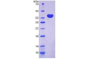 SDS-PAGE analysis of Human TLN2 Protein. (TLN2 Protein)