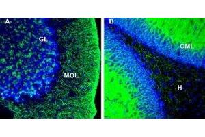 Expression of KCC2 in rat cerebellum and hippocampus. (Solute Carrier Family 12 (Potassium-Chloride Transporter) Member 5 (SLC12A5) Peptid)