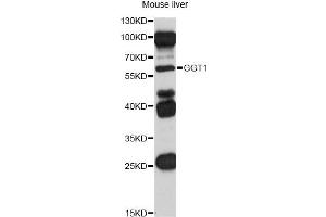 Western blot analysis of extracts of mouse liver, using GGT1 antibody (ABIN5970894) at 1/1000 dilution. (GGT1 Antikörper)
