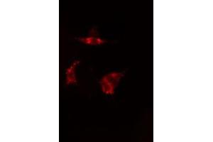 ABIN6277586 staining  HepG2 cells by IF/ICC.