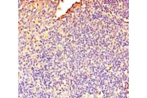 Immunohistochemistry of paraffin-embedded human tonsil tissue using ABIN7150574 at dilution of 1:100 (DOK5 Antikörper  (AA 1-198))